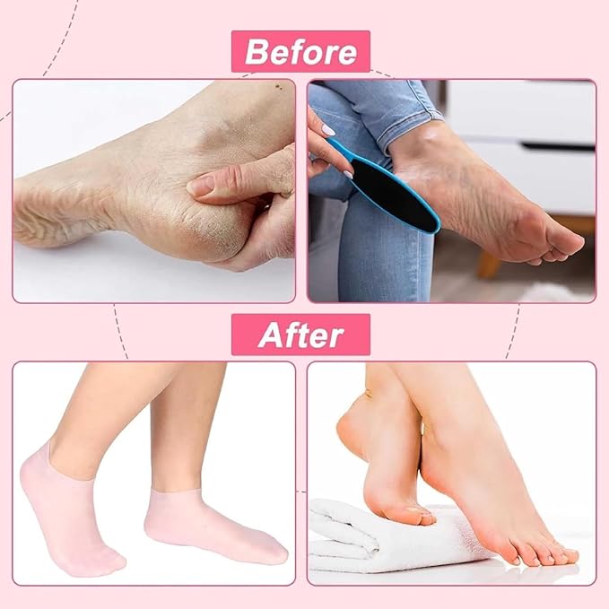 Silicone Moisturizing Gel Socks | Winter Cracked Heel Pain Socks | Waterproof socks for SPA